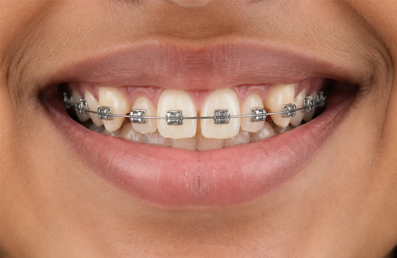 Before Image