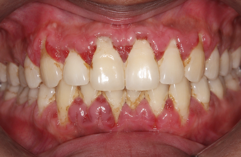 Before Image