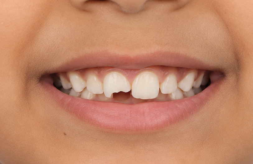 Before Image