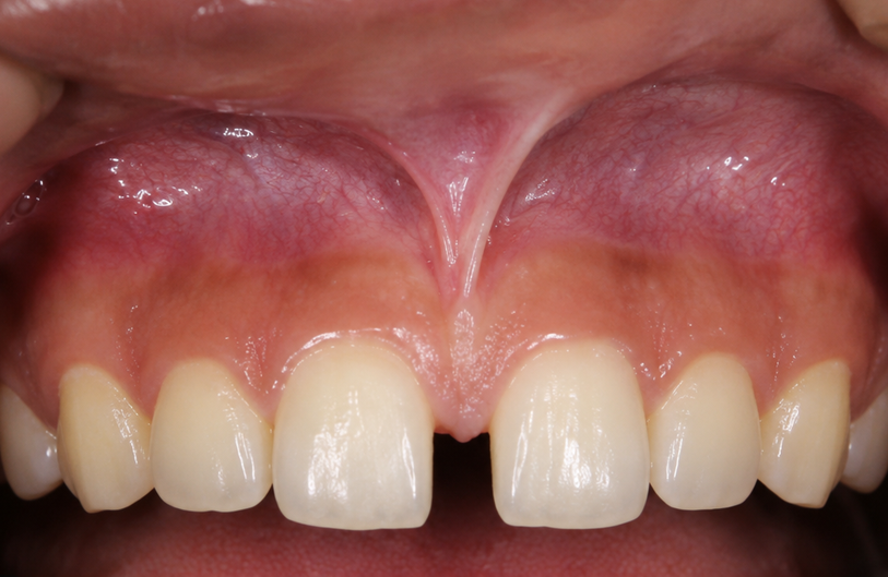 Before Image