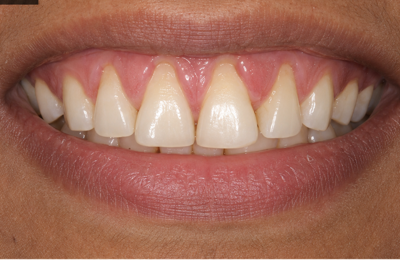Before Image