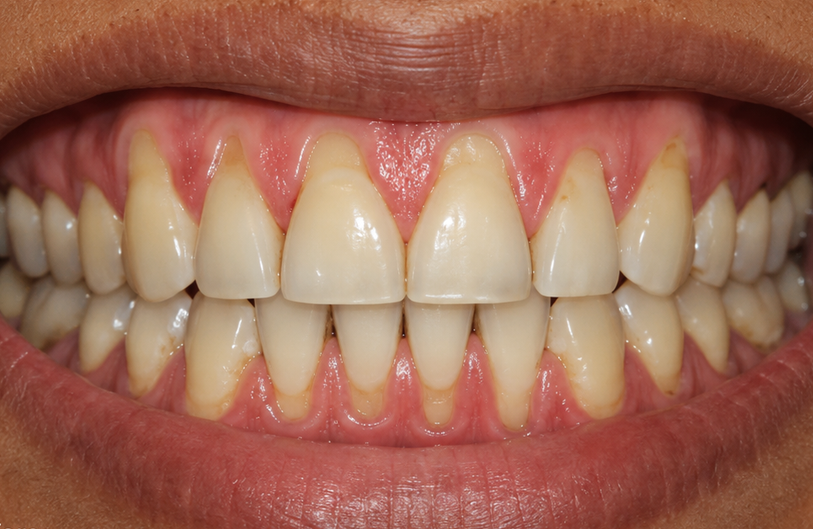 Before Image