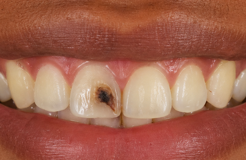 Before Image