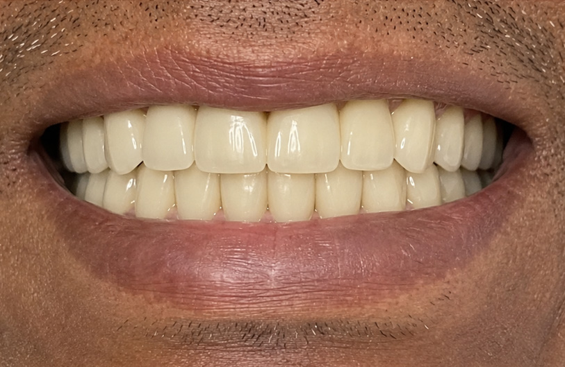 After Image