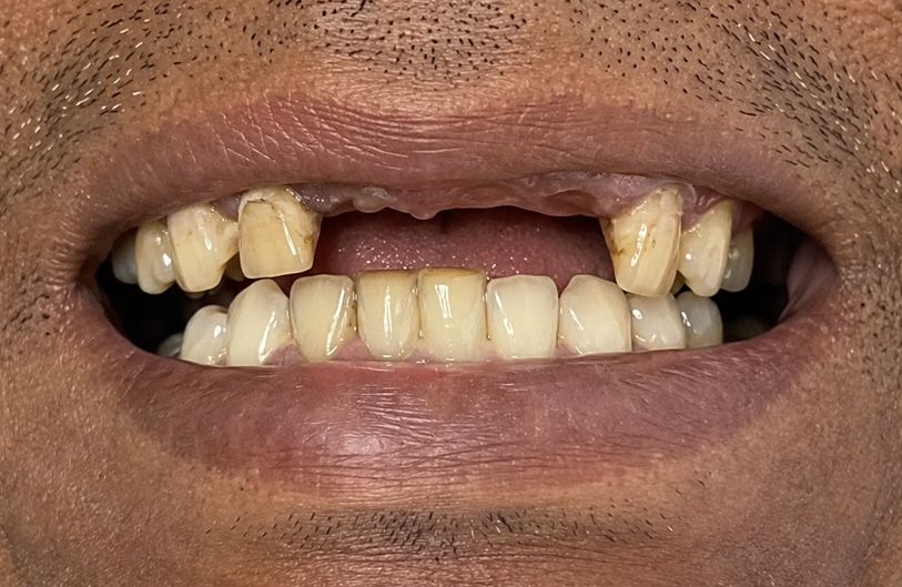 Before Image