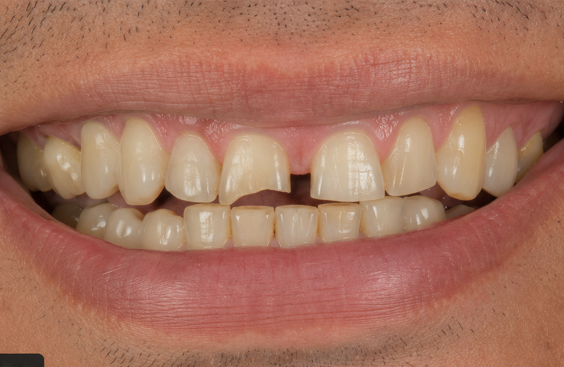 Before Image