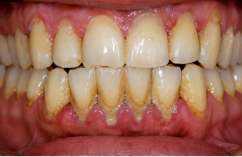 Before Image
