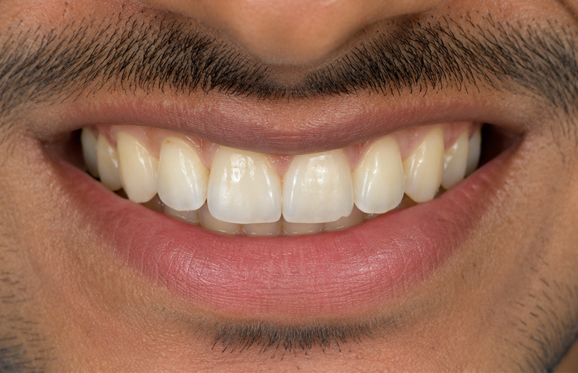 After Image