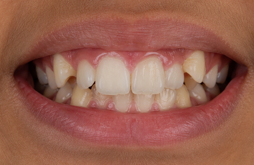 Before Image