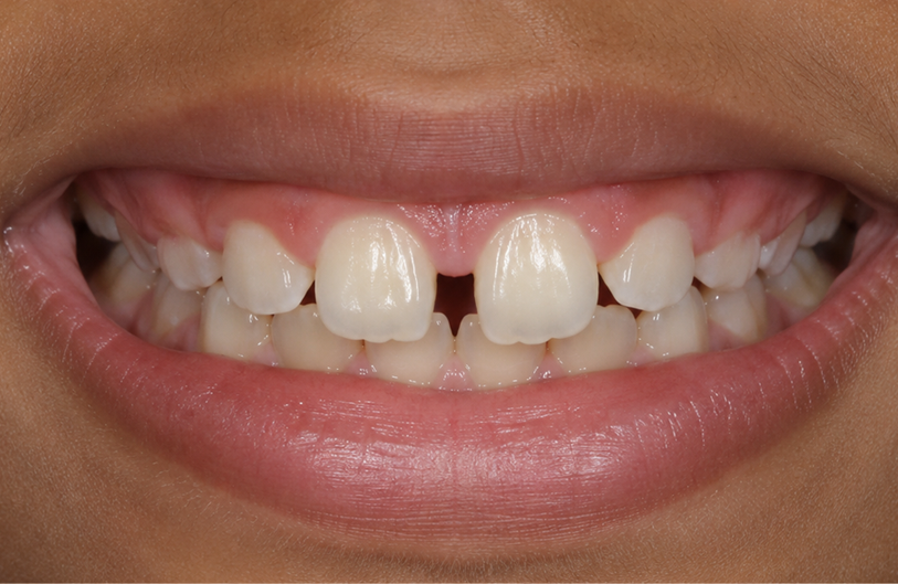 Before Image