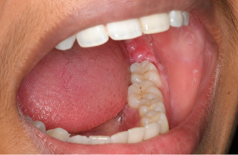 Before Image