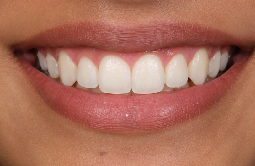 After Image