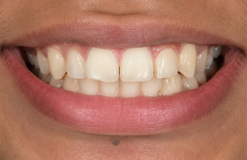 Before Image