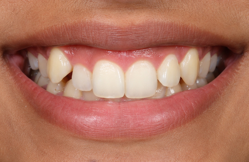 Before Image
