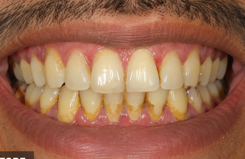 Before Image