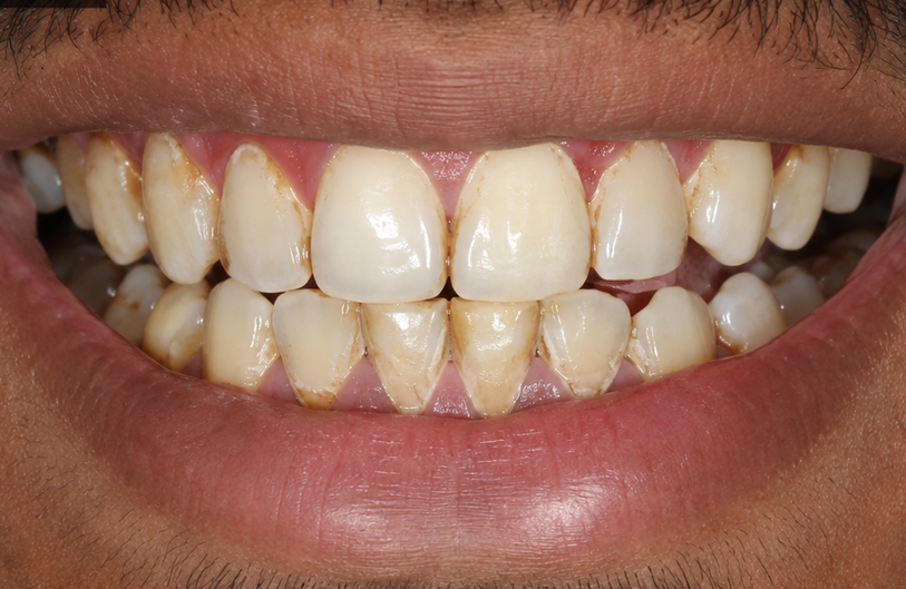 Before Image