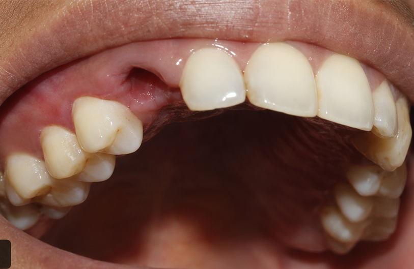 After Image