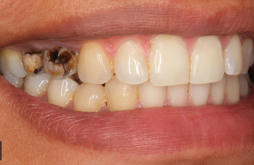 Before Image
