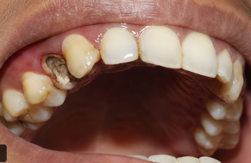Before Image