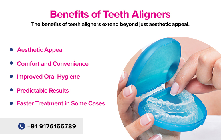 Benefits of Teeth Aligners