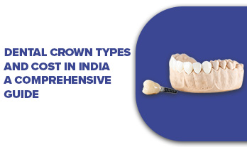 Dental Crown Types and Cost in India – A Comprehensive Guide