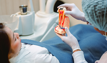 A Patient’s Guide: What to Expect from a Root Canal Treatment