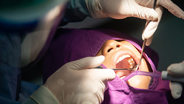 Wisdom Tooth Removal Surgery Cost and Procedure