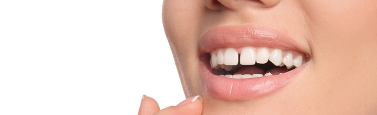 how to fix your teeth gaps