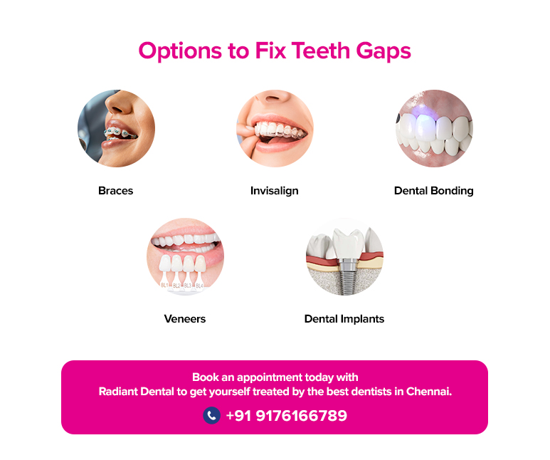 options to fix teeth gaps