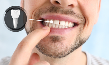 Invisalign Treatment at Radiant Dental