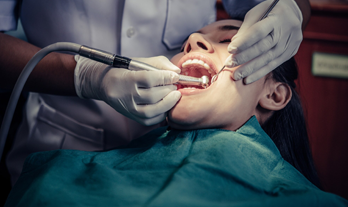 How Dental Posts Can Save Your Teeth: A Simple Guide