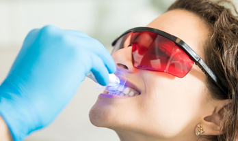 Understanding Teeth Whitening Process and Tips: Your Path to a Brighter Smile
