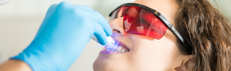 understanding teeth whitening process and tips