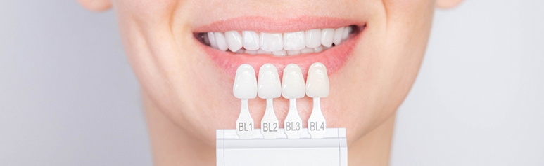 what are dental veneers and how do they work