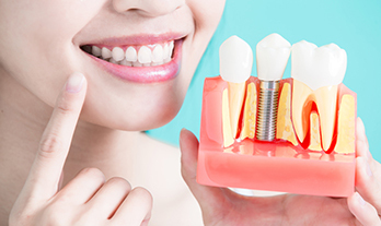 Know the Benefits of Dental Implants: Say Goodbye to Missing Teeth.