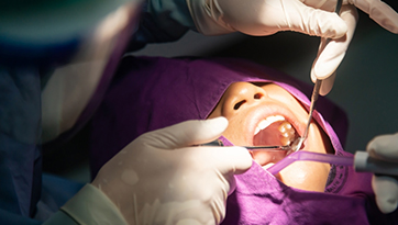 Do’s And Don’ts of Wisdom Tooth Removal