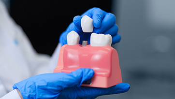 Understanding the Roles and Benefits of Dental Crowns for Stronger Teeth