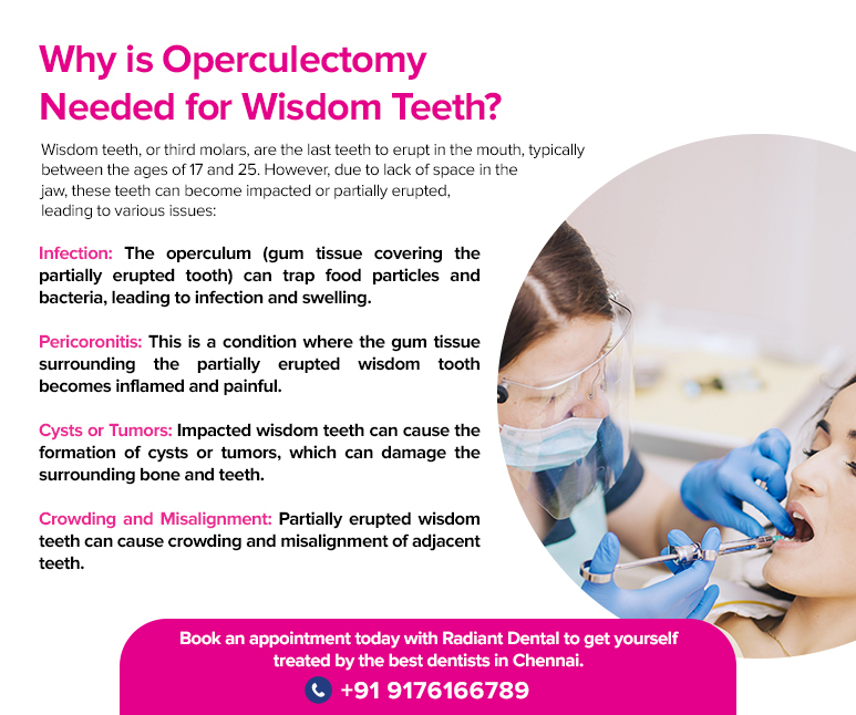 what is operculectomy surgery related to wisdom teeth