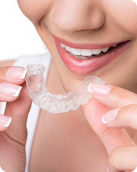 Aligners