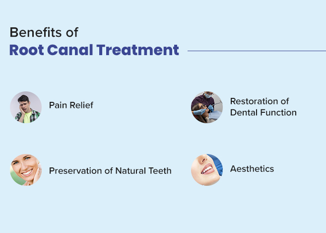 essential guide to understand root canal treatment