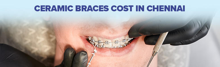 ceramic braces costs in chennai