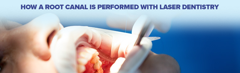 how a root canals is performed with laser dentistry