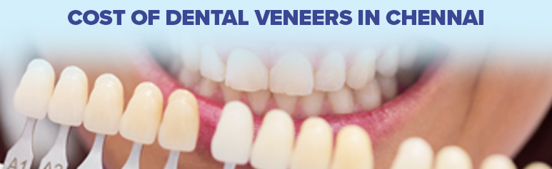 the dental veneers cost in chennai