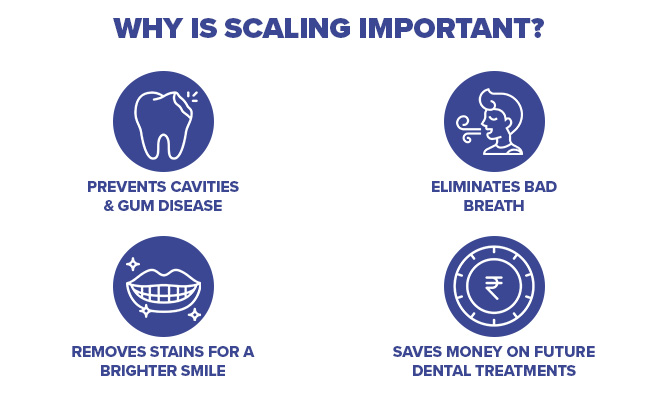 dental-scaling-and-why-do-you-need-it