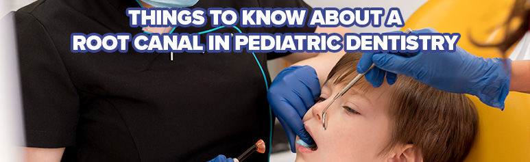 things to know about root canal in pediatric dentistry
