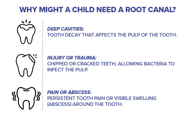 why might a child need a root canal