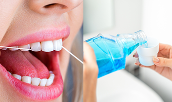 Flossing vs. Mouthwash: Which One Does More?