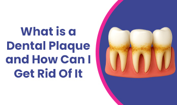 What Is a Dental Plaque and How Can I Get Rid Of It