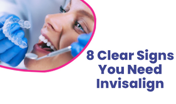 Invisalign Treatment in Chennai