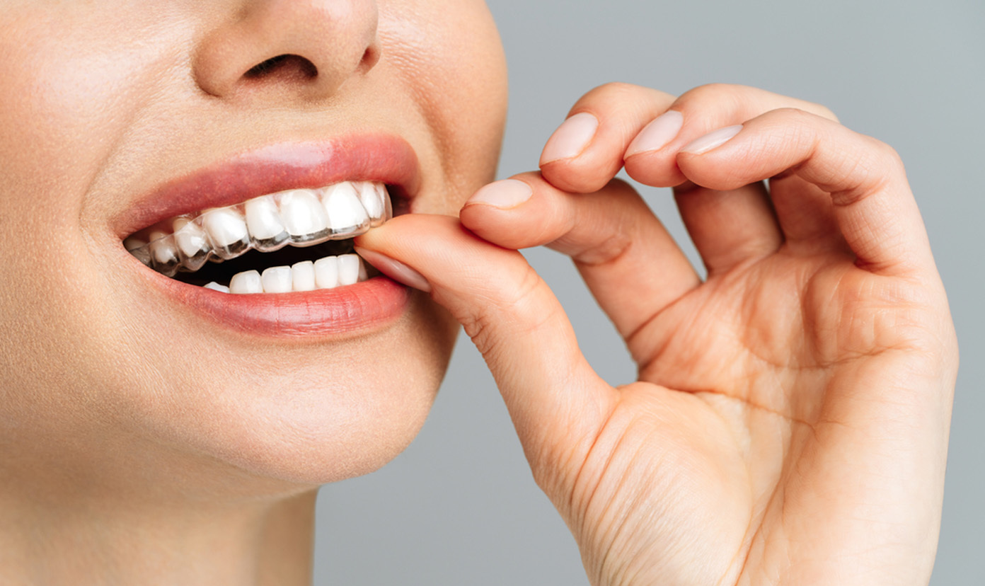 Invisalign Treatment in Perungudi